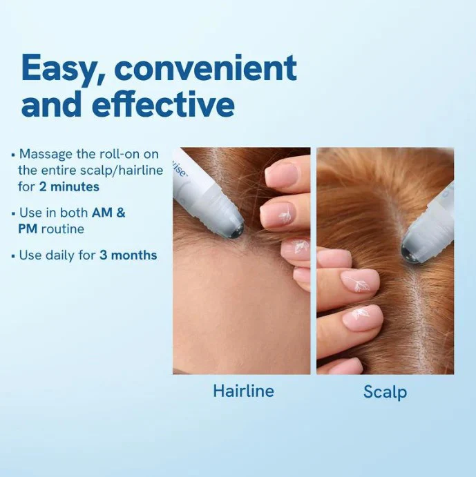 Hair Growth Roll On Serum - Image 4