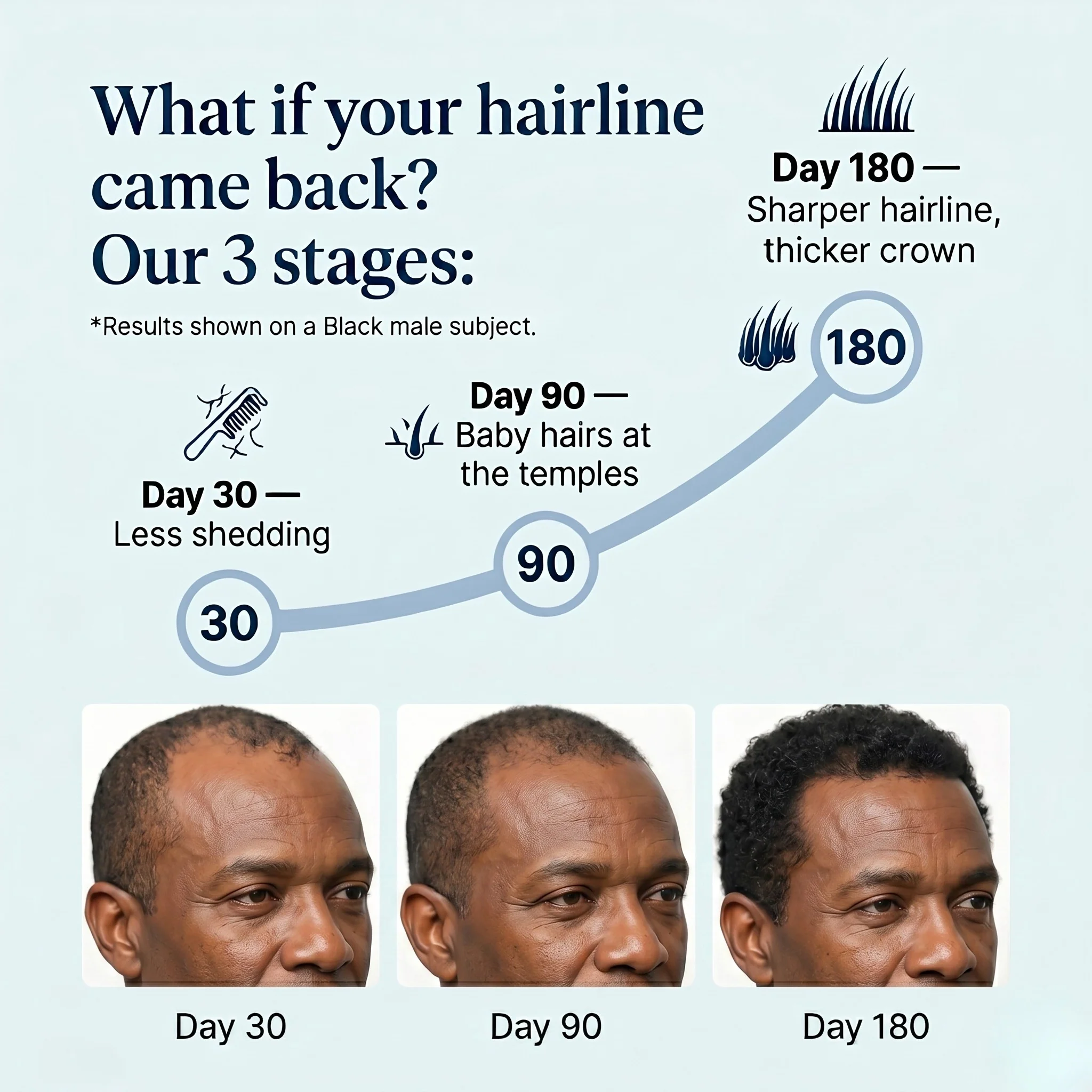 Hair Regrowth Roll-On Serum - Image 4